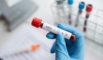 Türkiye’de HIV vakaları arttı: Haftada 2-3 hasta geliyor!