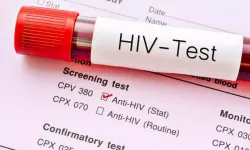 HIV erken tanı ve tedaviyle 'yönetilebilir' bir hastalık