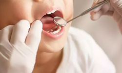 Uzmanlar uyarıyor: Çürük süt dişleri sürekli dişleri de çürütüyor, 6 yaşından önce önlemini alın