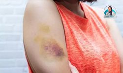 Dünya Hemofili Günü: Belirtileri neler, tehlikeli bir hastalık mı?