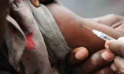 Nijerya'da kızamık salgınında 19 çocuk hayatını kaybetti