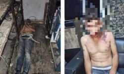 Şanlıurfa'da yevmiyesini isteyen işçiye işkence: Dişleri söküldü