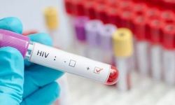 İl Sağlık Müdürlüğü'nden AIDS'ten ölen çocuk açıklaması