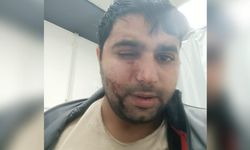 Trafikte ‘kör eden’ saldırgan 2 ay sonra serbest