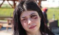 Yüzünde kırıklar oluşmuştu, sanık tutuksuz yargılanacak
