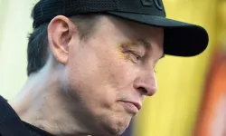 Elon Musk’ın gözündeki morluğun nedeni belli oldu: 'Suratıma yumruk at'