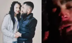 Ankara’da eski sevgiliye işkence: 'Burnunu ve kulağını yedim'