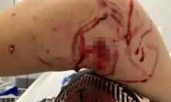 Kocaeli'de başıboş köpekler kadını parçaladı
