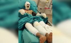 Orman yangınında yaralanan orman işçisinin son hali ortaya çıktı