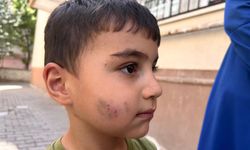 Ankara’da uyuyan çocuğu lağım faresi ısırdı: Kuduz aşısı yapıldı