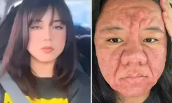 28 yaşındaki kadın bir günde 30 yıl yaşlandı