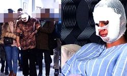 'Seni Bergen gibi yapacağım dedi, yüzümü paramparça etti'