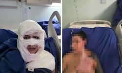 Bir kadın, bir başka kadın tarafından üzerine yanıcı madde dökülerek ateşe verildi