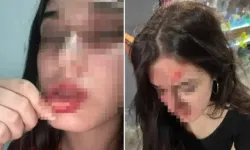 Eski sevgilisi ‘konuşacağız’ diyerek tuzağa düşürdü, öldüresiye dövdü