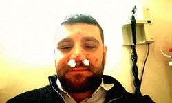 Trafikte yol verme tartışmasında avukatın burnu kırıldı