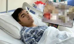 'Çiğ' şekilde yedi, karaciğeri iflas etti