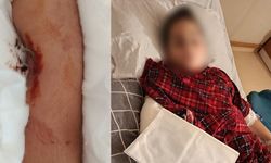 İstanbul'da akran zorbalığı: Arkadaşının kolunu 2 yerden kırdı