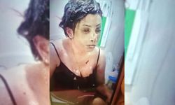 Boşanma aşamasındaki eşini koli bandı ile bağlayıp, başından aşağı kezzap döktü