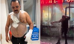 Soğuk havada kaynar su videosu çekmek isterken kendini yaktı!