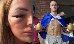 Kendisini reddeden kadını hastanelik etti!