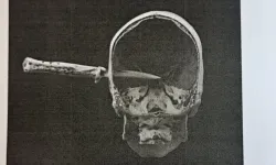 Nişanlısını dövdü, kuzeninin kafasına bıçak sapladı