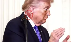 Trump’ın boynundaki kızarıklık gündem oldu: Doktorundan açıklama!
