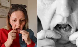 Bir günde 25 dişi çekildi, hayatı karardı