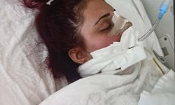 Burun estetiği ameliyatı sonrası hayatını kaybetti