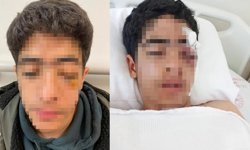 İstanbul'da akran zorbalığı: 15 yaşındaki çocuğa muştalı saldırı