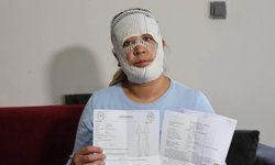 'Prenses cilt bakım' yaptırmak isterken yüzünde ikinci derece yanıklar oluştu!