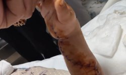 Adana'da tomografiye giren çocuk ölümden döndü