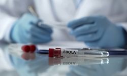 Ebola virüsü nedir? Ebola virüsü belirtileri nelerdir, nasıl bulaşır, kimler risk altında?