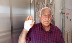 Komşusunun parmağını ısırarak kopardı!