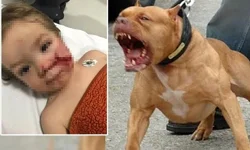 Ankara'da 2 kardeşe saldırıp yaralayan pitbullun sahibi tahliye edildi