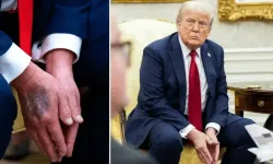 ABD Başkanı Donald Trump, sağlık kontrolünden geçecek
