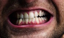Diş aşınması ve boyun tutulması yaşayanlar dikkat!