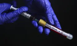 DSÖ'den Ebola virüsüyle ilgili kritik uyarı!