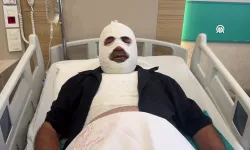 Hararet yapan araca soğumadan müdahale etti, ağır yaralandı