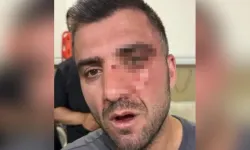 Van'da sağlıkçıya saldırı