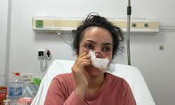 Eşi tarafından burnu ısırılıp koparılan kadın, dehşet dolu anları anlattı!