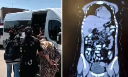 Midesinden 1,5 kilo metamfetamin çıktı: 2 kadın kurye tutuklandı