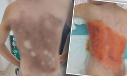 İstanbul'da korkunç olay; 12 yaşındaki çocuğu arka mahalleye götürüp yaktılar