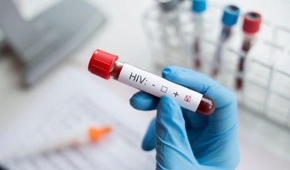 Türkiye’de HIV vakaları arttı: Haftada 2-3 hasta geliyor!