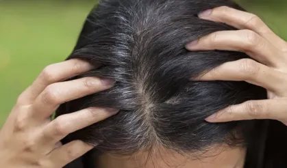 Gençlikte saç beyazlamasının nedeni ortaya çıktı