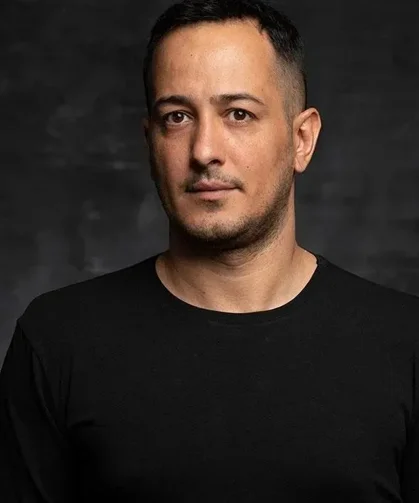 Sarp Apak: 'Bir yıl boyunca yüzüme topuk kremi sürdüm'