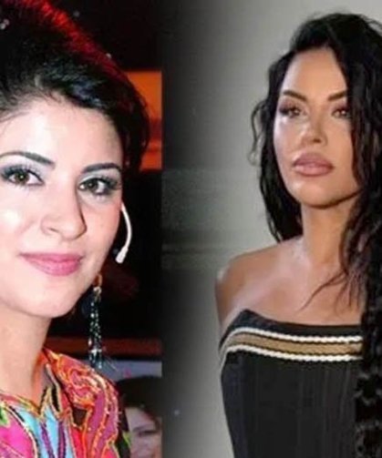 Zara’nın son hali olay oldu: Estetik mi, Photoshop mu?
