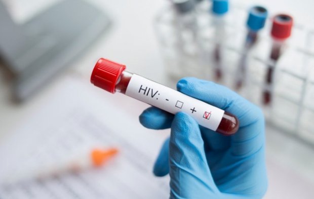 Türkiye’de HIV vakaları arttı: Haftada 2-3 hasta geliyor!