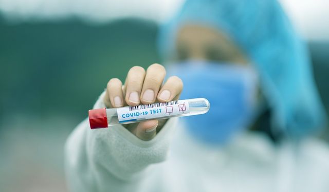 Covid sonrası kalıcı tat kaybının nedeni belli oldu