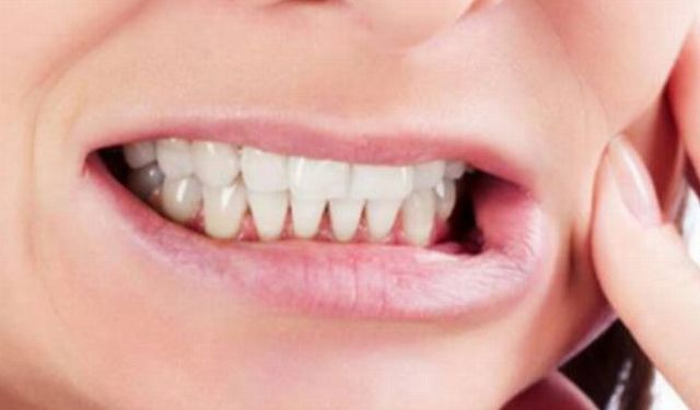 Diş sıkma sorunu tedavi edilmediğinde çene ve ruh sağlığını olumsuz etkiliyor