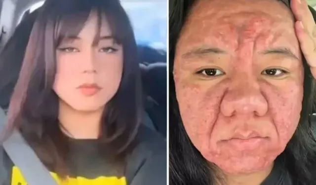 28 yaşındaki kadın bir günde 30 yıl yaşlandı... Sebebi ortaya çıktı